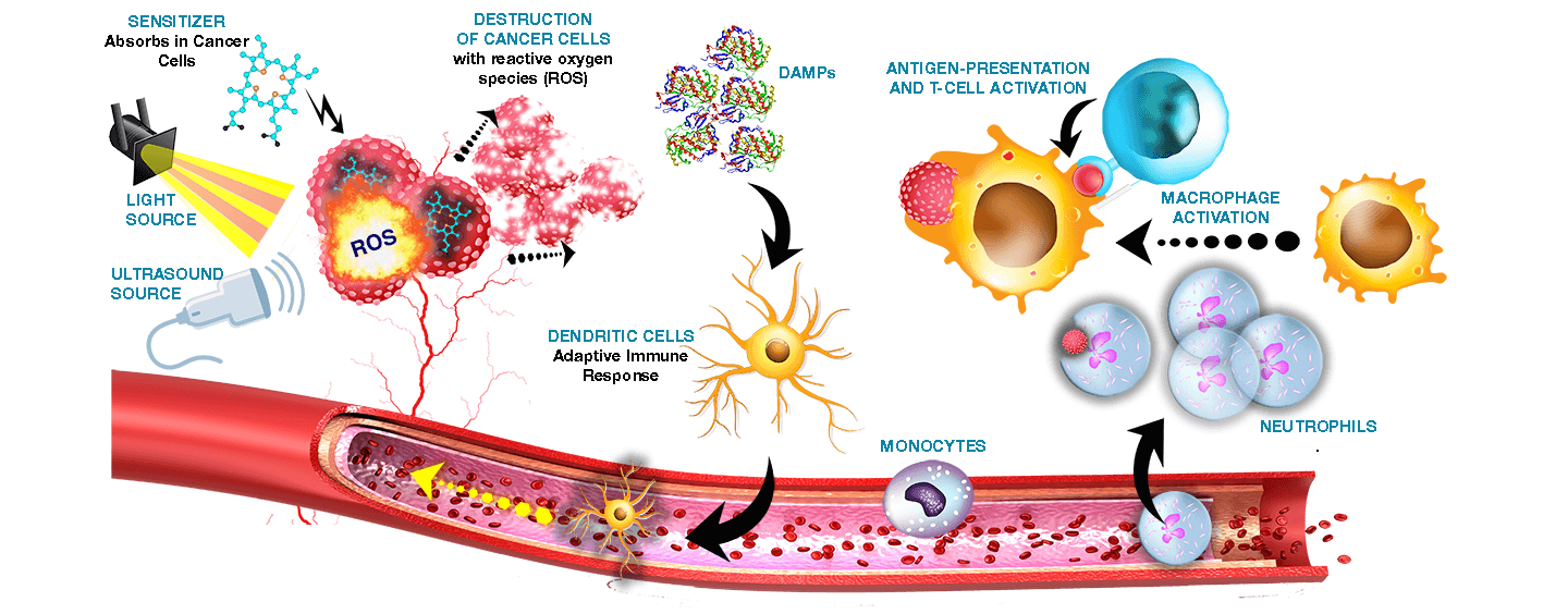 Sono-Photo Dynamic Therapy (SPDT)